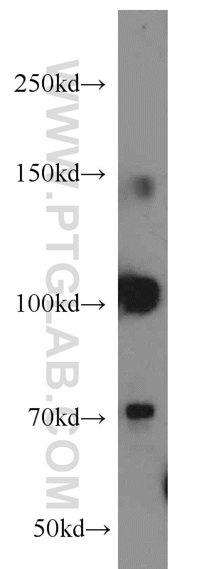 Western Blot (WB) analysis of HeLa cells using RBM15B Polyclonal antibody (22249-1-AP)