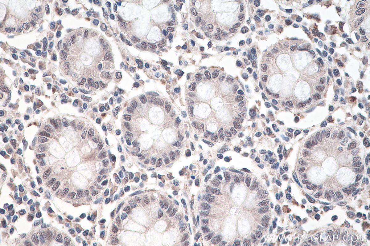 Immunohistochemistry (IHC) staining of human colon tissue using RBM15B Monoclonal antibody (67506-1-Ig)