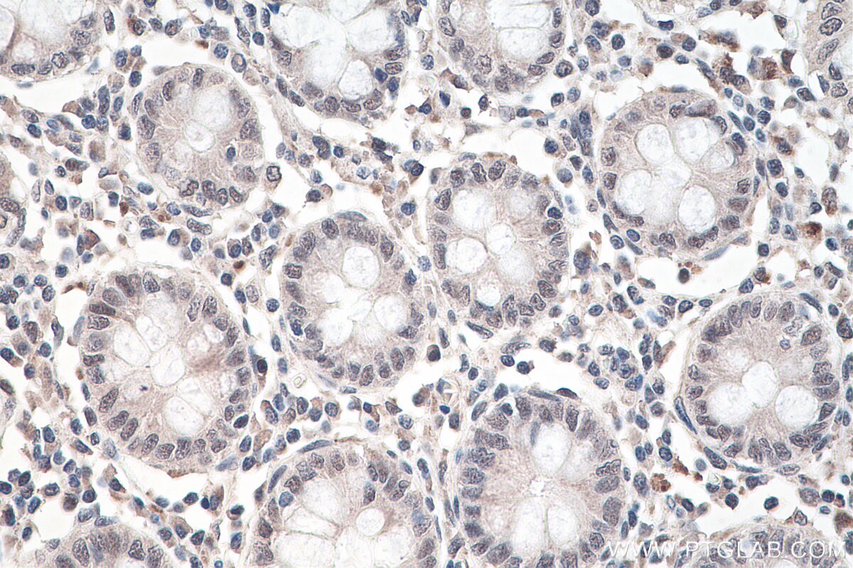 Immunohistochemistry (IHC) staining of human colon tissue using RBM15B Monoclonal antibody (67506-1-Ig)