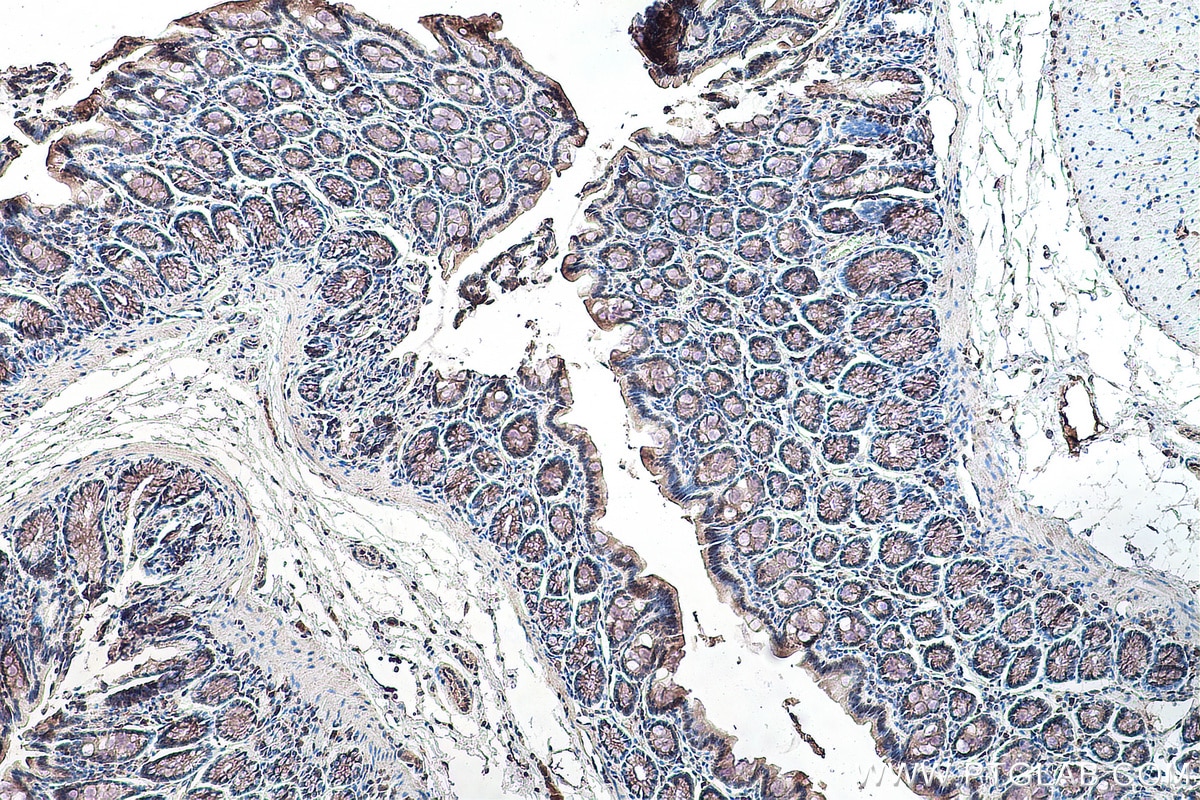 Immunohistochemistry (IHC) staining of rat colon tissue using RBM15B Monoclonal antibody (67506-1-Ig)