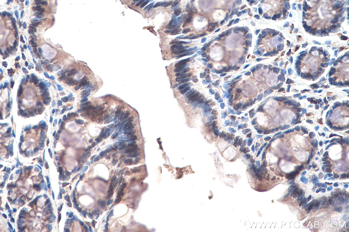 IHC staining of rat colon using 67506-1-Ig