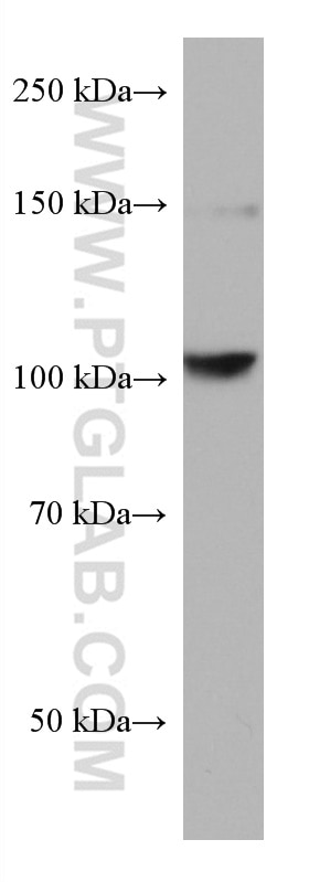 Western Blot (WB) analysis of K-562 cells using RBM15B Monoclonal antibody (67506-1-Ig)