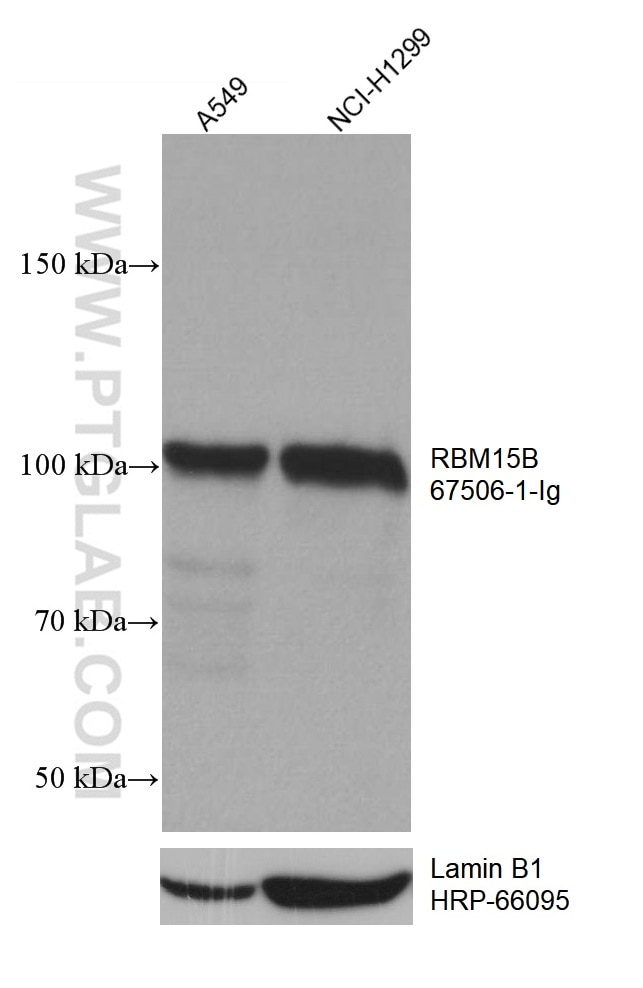 Western Blot (WB) analysis of A549 cells using RBM15B Monoclonal antibody (67506-1-Ig)