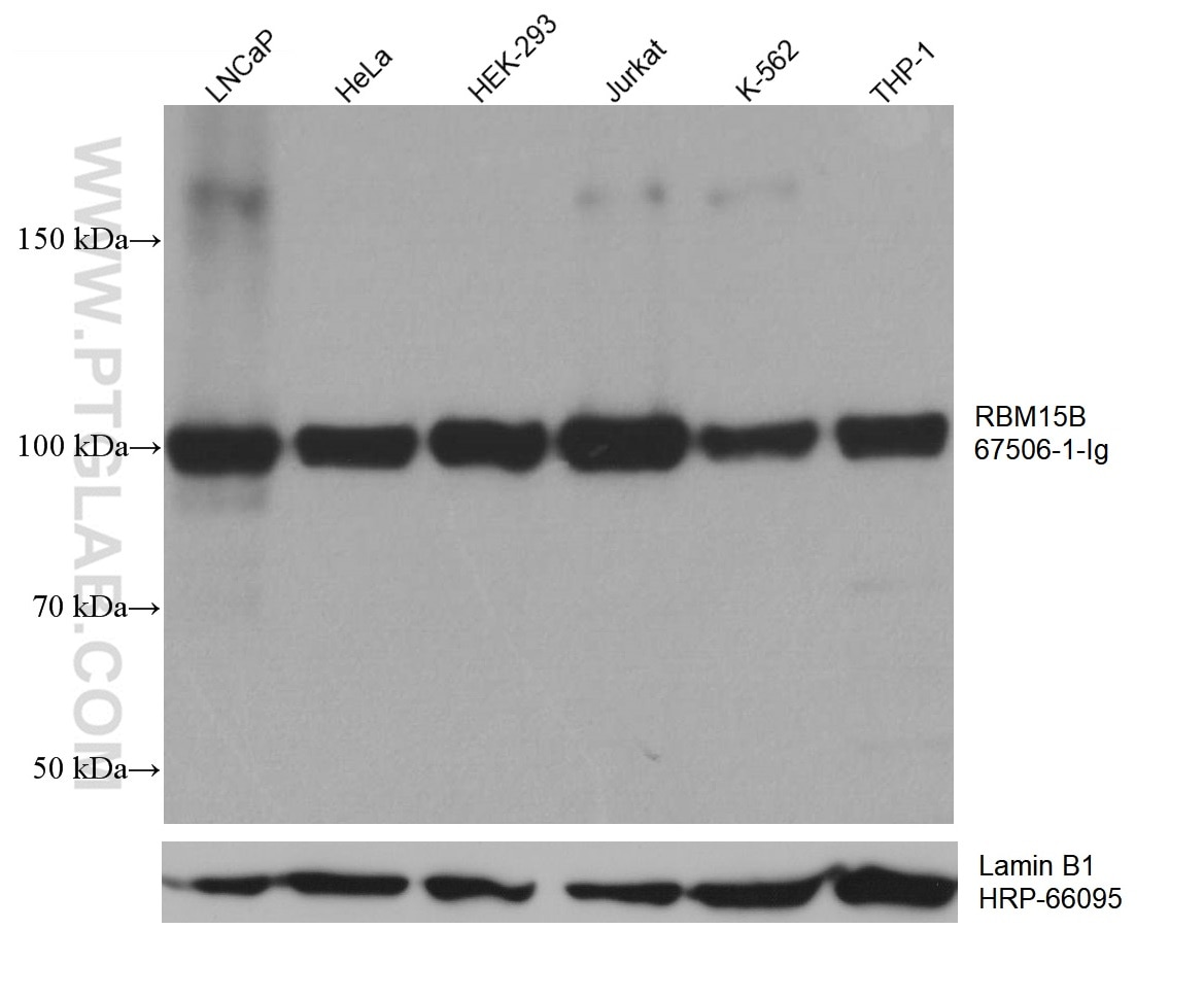 Western Blot (WB) analysis of various lysates using RBM15B Monoclonal antibody (67506-1-Ig)