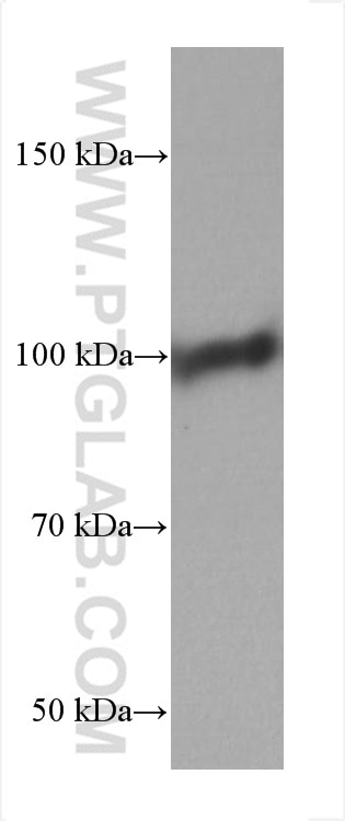 Western Blot (WB) analysis of COLO 320 cells using RBM15B Monoclonal antibody (67506-1-Ig)