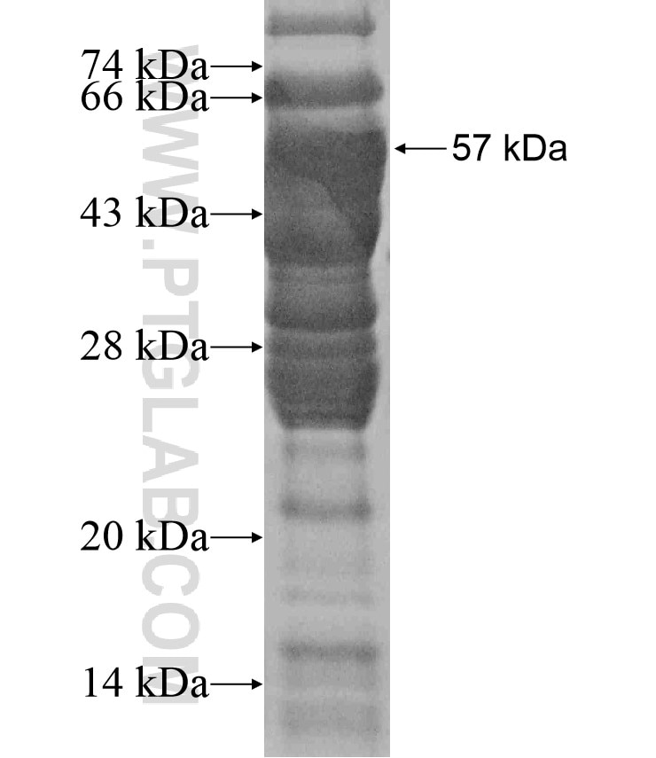 RBM15B fusion protein Ag17744 SDS-PAGE