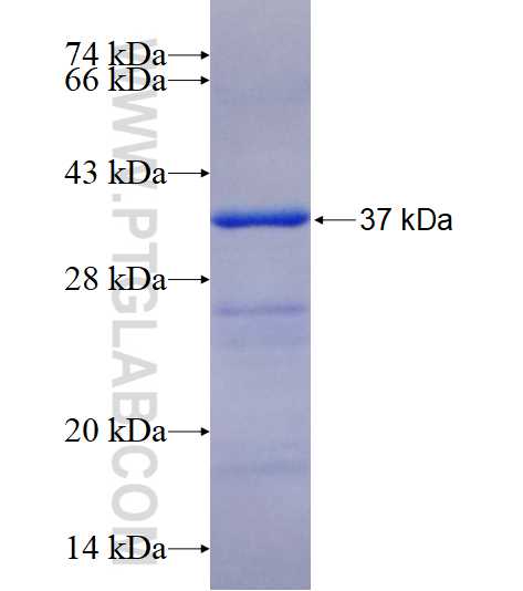 RBM15B fusion protein Ag17853 SDS-PAGE