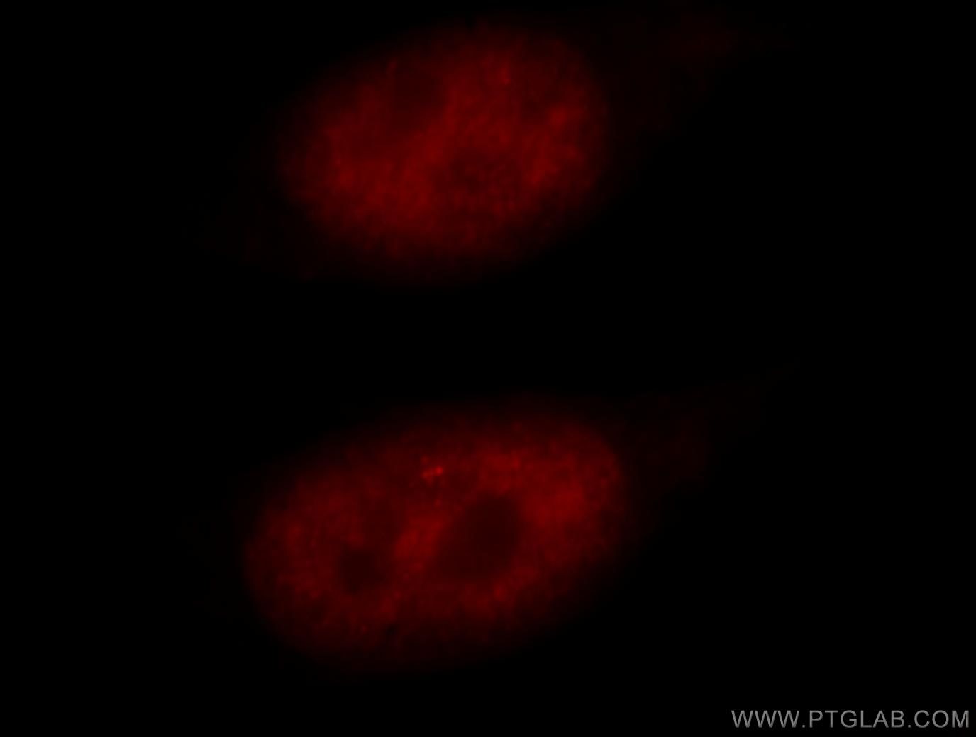 Immunofluorescence (IF) / fluorescent staining of HeLa cells using RBM16 Polyclonal antibody (18893-1-AP)