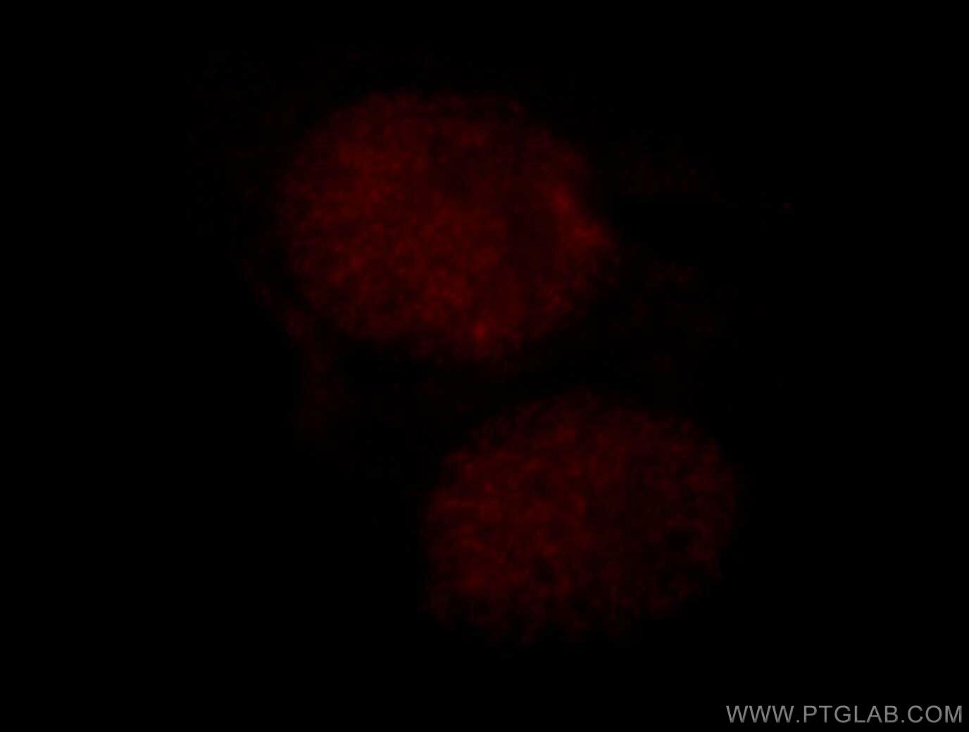 Immunofluorescence (IF) / fluorescent staining of HepG2 cells using RBM16 Polyclonal antibody (18893-1-AP)