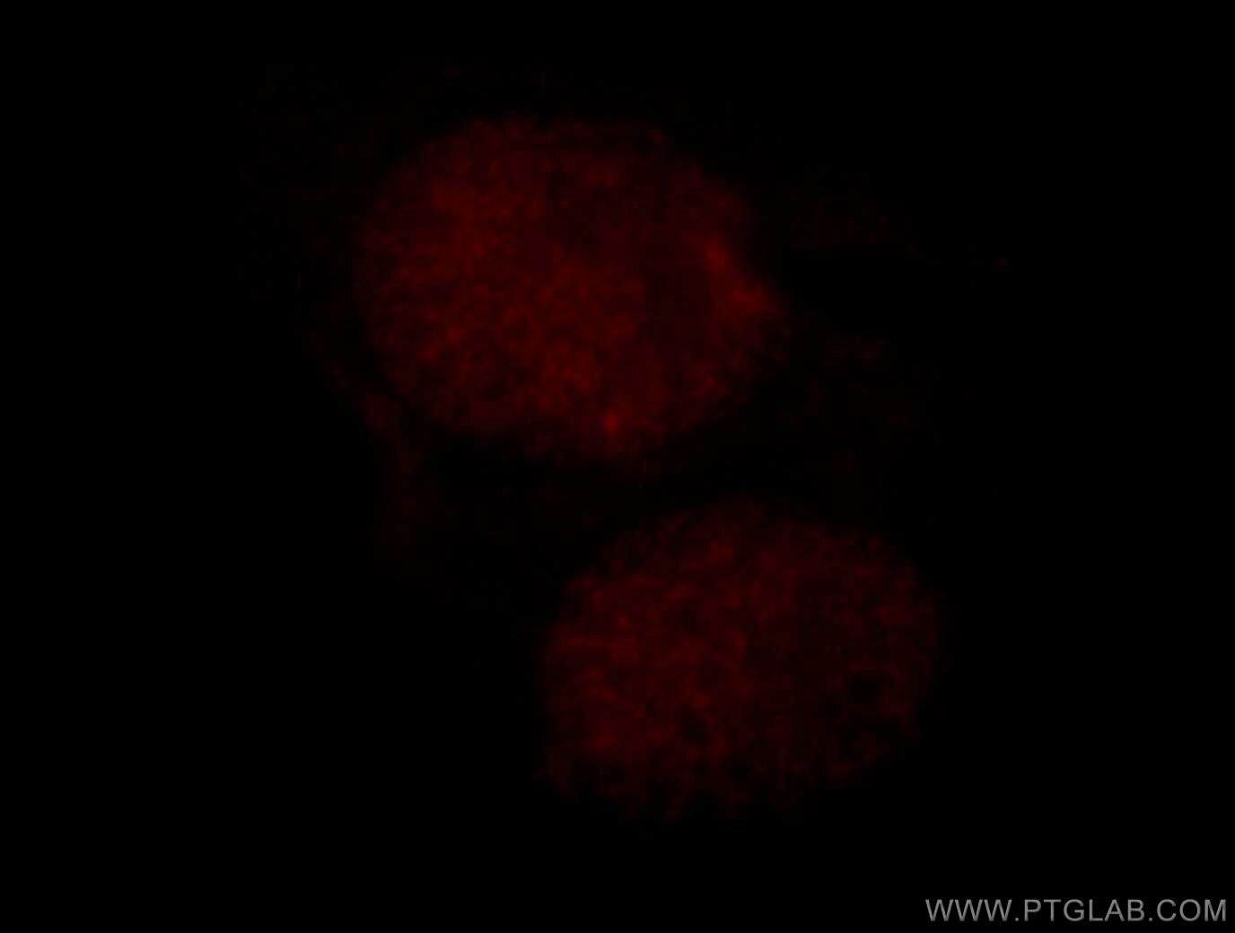 IF Staining of HepG2 using 18893-1-AP