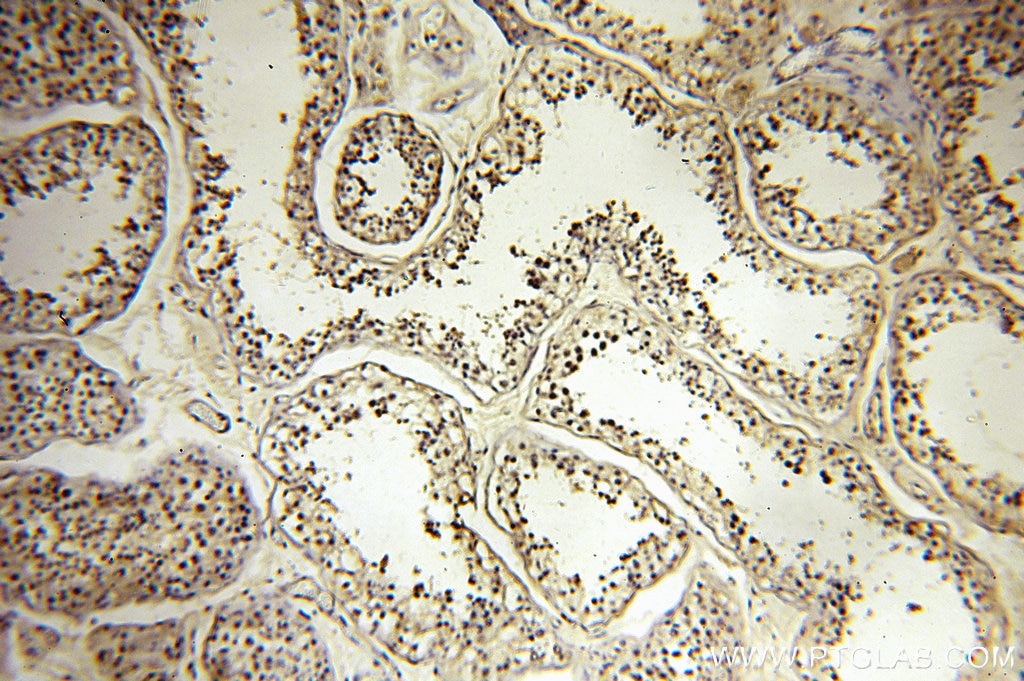 IHC staining of human testis using 18893-1-AP