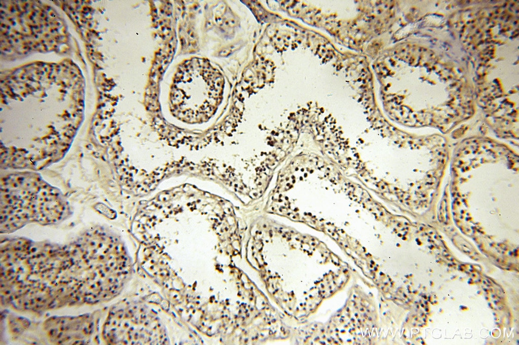 Immunohistochemistry (IHC) staining of human testis tissue using RBM16 Polyclonal antibody (18893-1-AP)