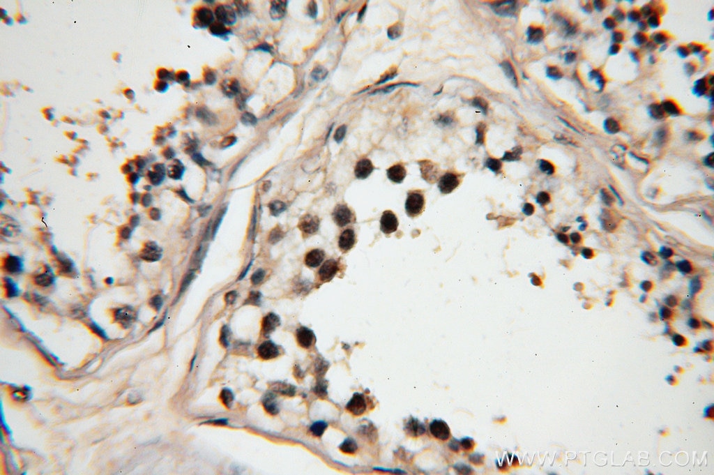 Immunohistochemistry (IHC) staining of human testis tissue using RBM16 Polyclonal antibody (18893-1-AP)