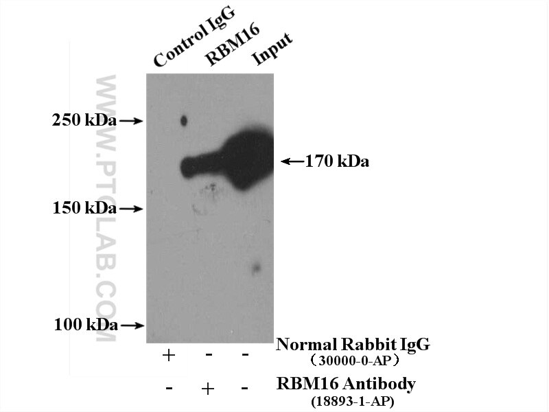 Immunoprecipitation (IP) experiment of HeLa cells using RBM16 Polyclonal antibody (18893-1-AP)