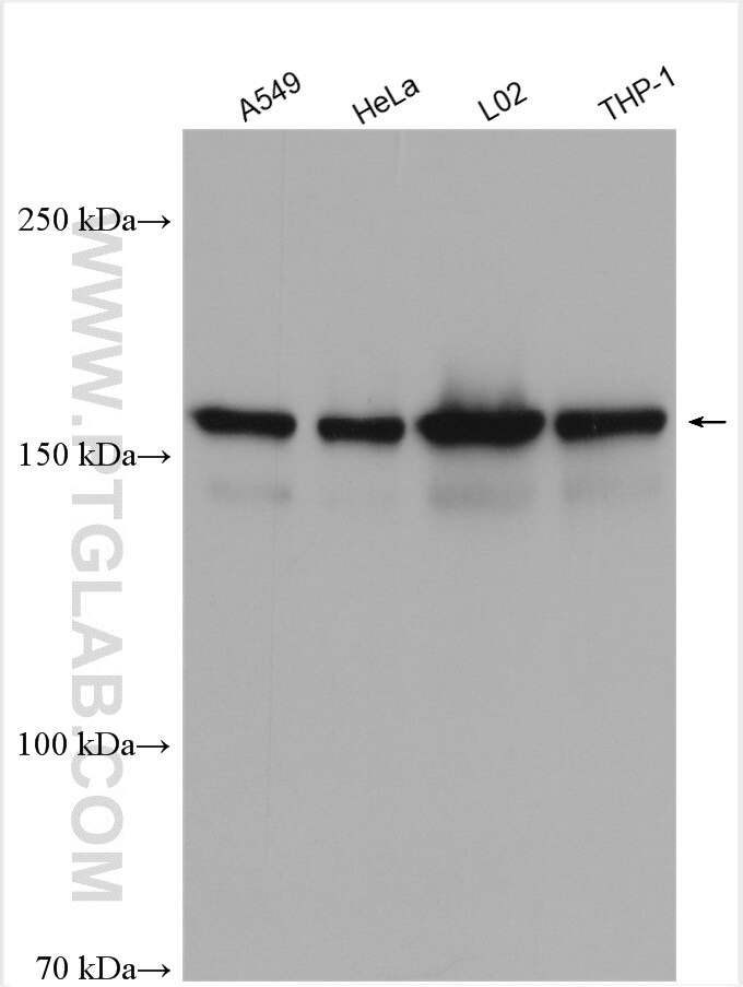 Western Blot (WB) analysis of various lysates using RBM16 Polyclonal antibody (18893-1-AP)