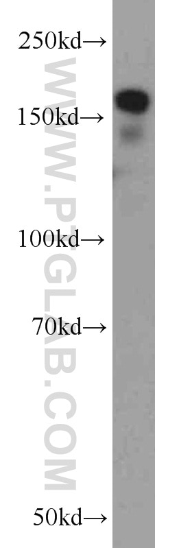 Western Blot (WB) analysis of HeLa cells using RBM16 Polyclonal antibody (18893-1-AP)