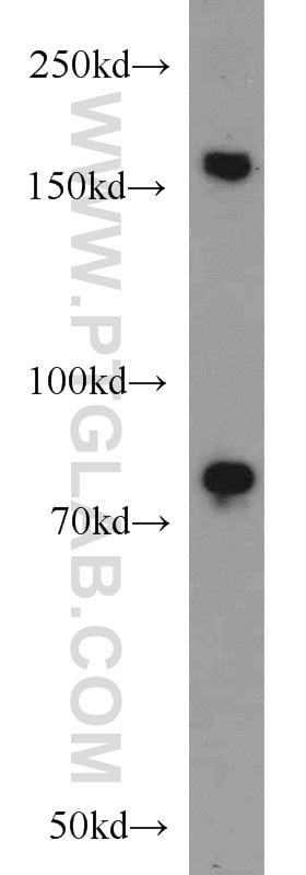 Western Blot (WB) analysis of NIH/3T3 cells using RBM16 Polyclonal antibody (18893-1-AP)