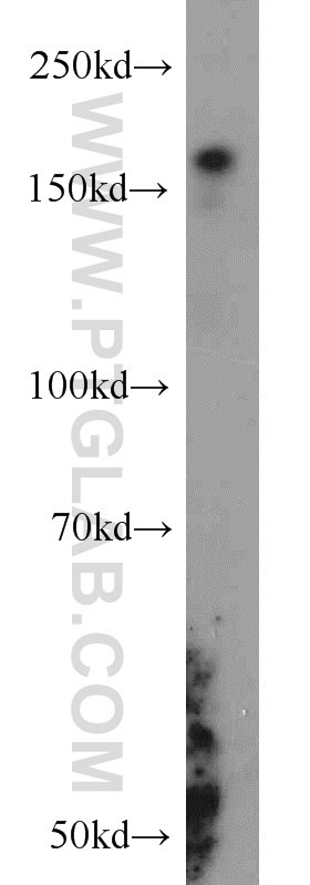 Western Blot (WB) analysis of A549 cells using RBM16 Polyclonal antibody (18893-1-AP)