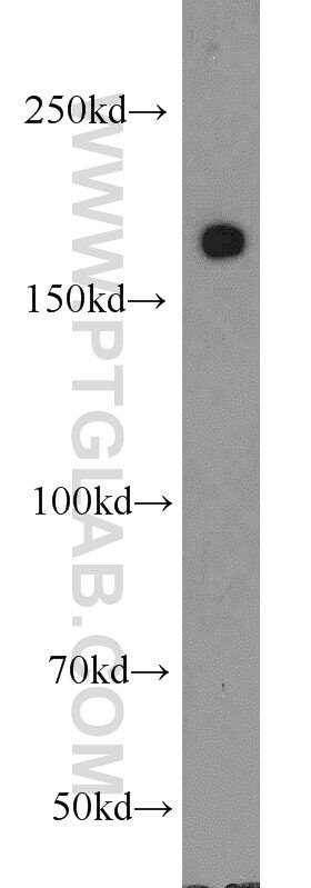 WB analysis of L02 using 18893-1-AP