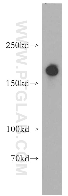 Western Blot (WB) analysis of HT-1080 cells using RBM16 Polyclonal antibody (18893-1-AP)