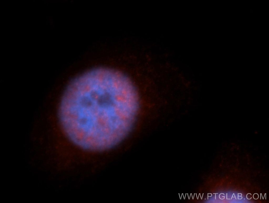 Immunofluorescence (IF) / fluorescent staining of HeLa cells using RBM17 Polyclonal antibody (13918-1-AP)