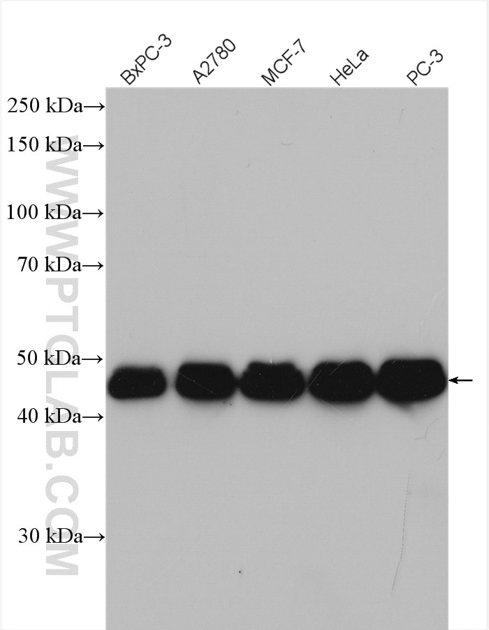 Western Blot (WB) analysis of various lysates using RBM17 Polyclonal antibody (13918-1-AP)