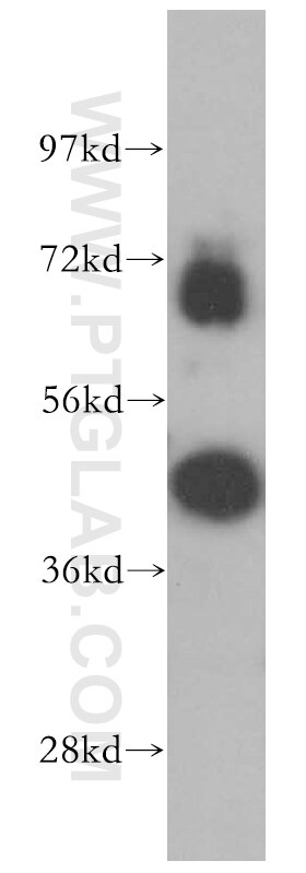 Western Blot (WB) analysis of MCF-7 cells using RBM17 Polyclonal antibody (13918-1-AP)