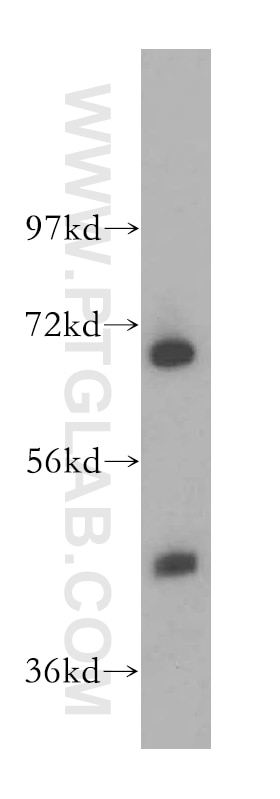 Western Blot (WB) analysis of HeLa cells using RBM17 Polyclonal antibody (13918-1-AP)