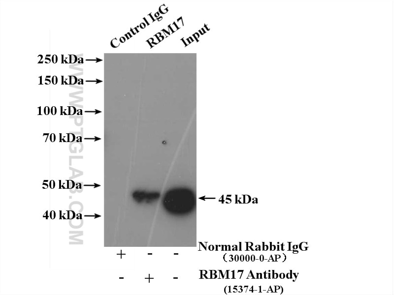 Immunoprecipitation (IP) experiment of HeLa cells using RBM17 Polyclonal antibody (15374-1-AP)