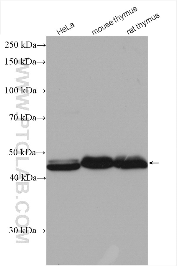 Western Blot (WB) analysis of various lysates using RBM17 Polyclonal antibody (15374-1-AP)
