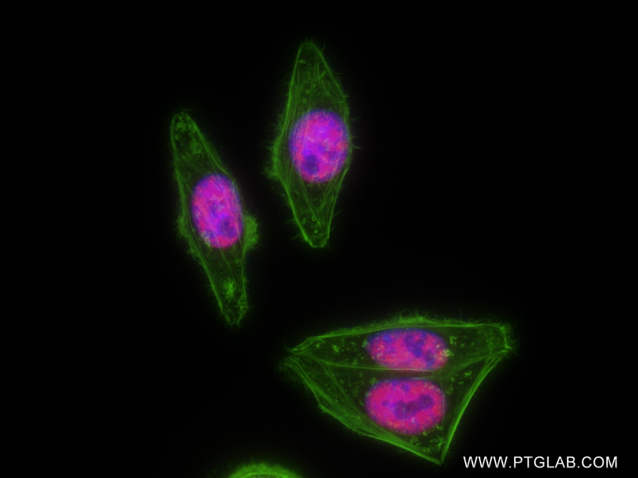 Immunofluorescence (IF) / fluorescent staining of HepG2 cells using RBM17 Recombinant antibody (82889-1-RR)