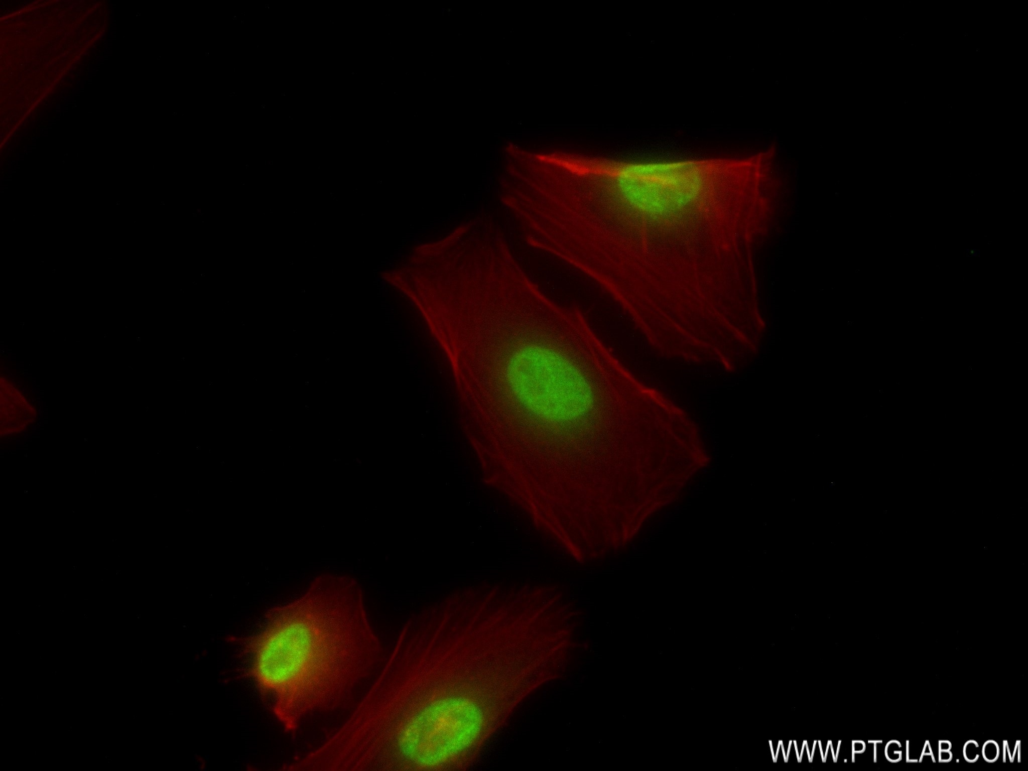 Immunofluorescence (IF) / fluorescent staining of HeLa cells using RBM17 Recombinant antibody (82889-2-RR)
