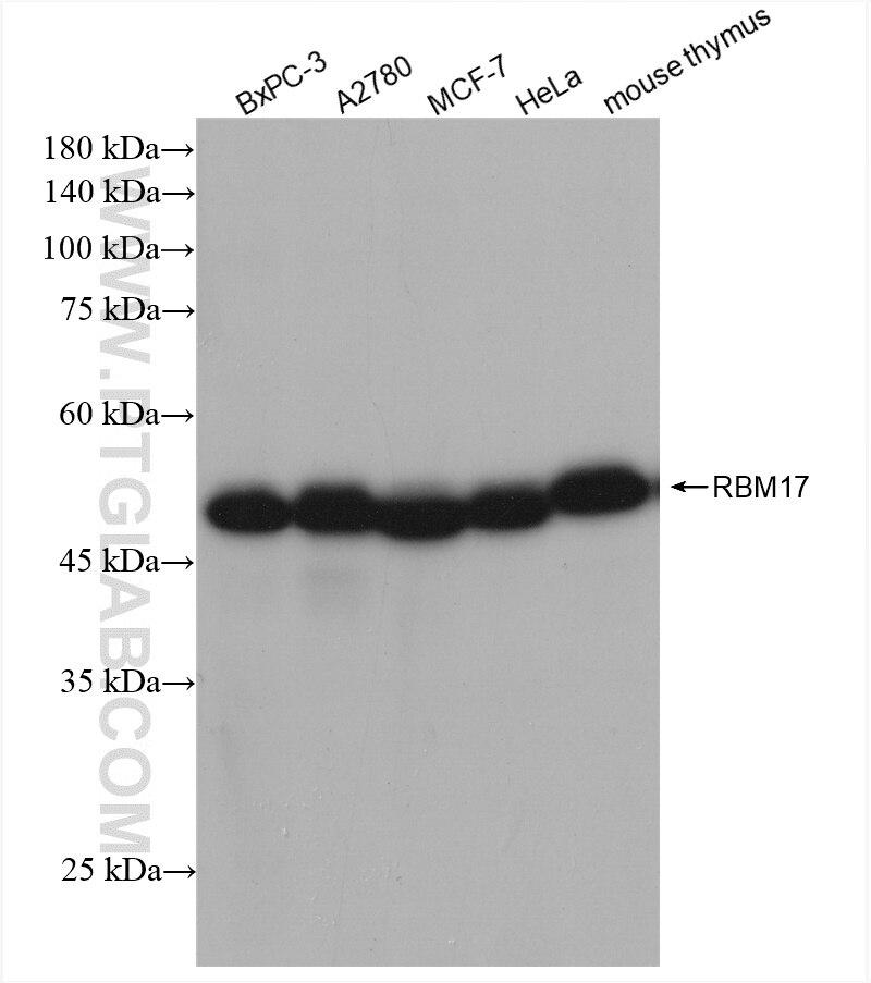 Western Blot (WB) analysis of various lysates using RBM17 Recombinant antibody (82889-3-RR)