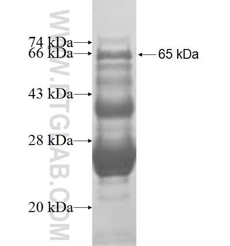 RBM17 fusion protein Ag0985 SDS-PAGE