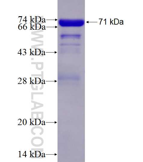 RBM17 fusion protein Ag4921 SDS-PAGE