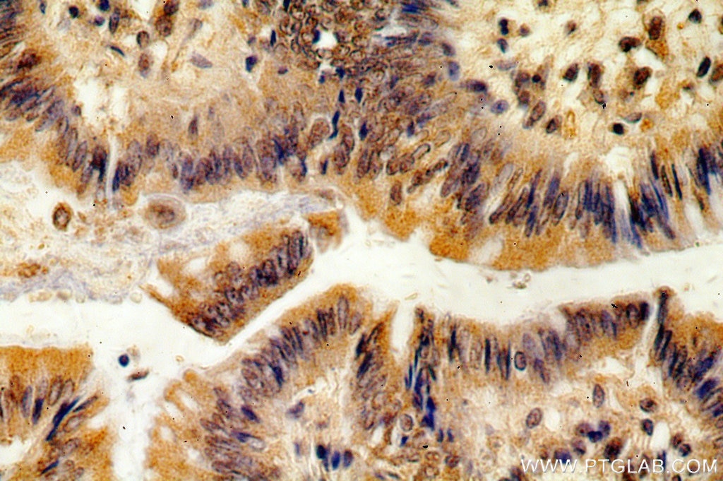 Immunohistochemistry (IHC) staining of human colon tissue using RBM19 Polyclonal antibody (19095-1-AP)