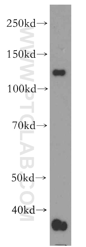 Western Blot (WB) analysis of COLO 320 cells using RBM19 Polyclonal antibody (19095-1-AP)