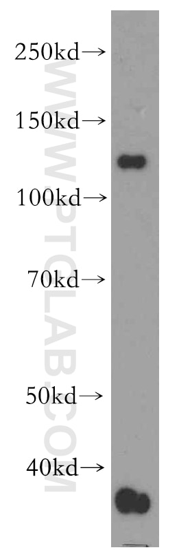 WB analysis of COLO 320 using 19095-1-AP