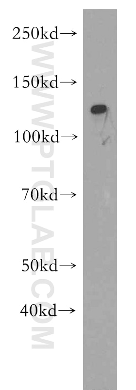 Western Blot (WB) analysis of mouse small intestine tissue using RBM19 Polyclonal antibody (19095-1-AP)