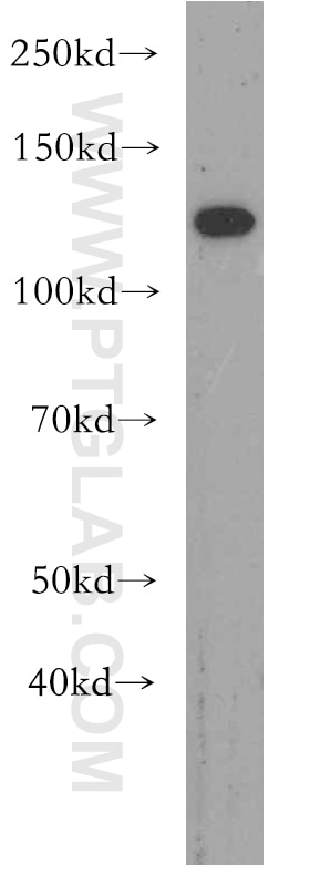 Western Blot (WB) analysis of mouse colon tissue using RBM19 Polyclonal antibody (19095-1-AP)