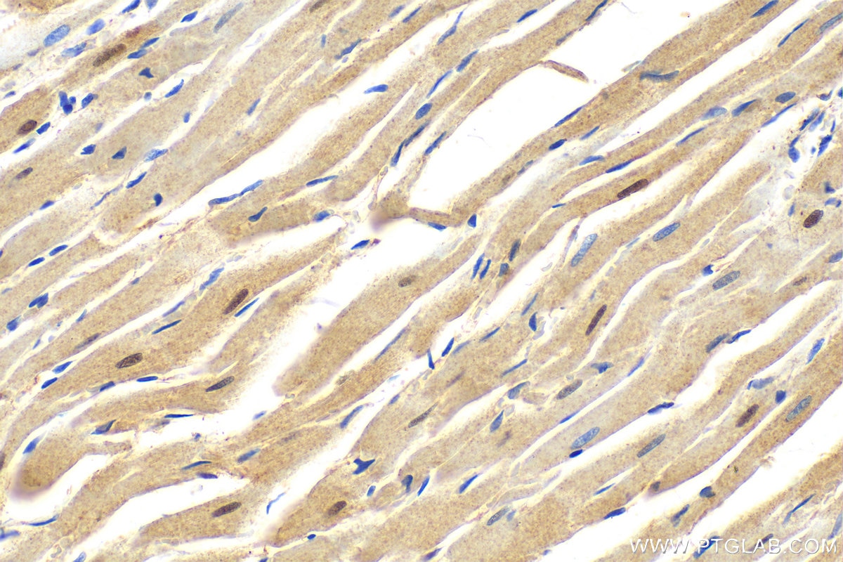 Immunohistochemistry (IHC) staining of rat heart tissue using RBM20 Polyclonal antibody (31177-1-AP)