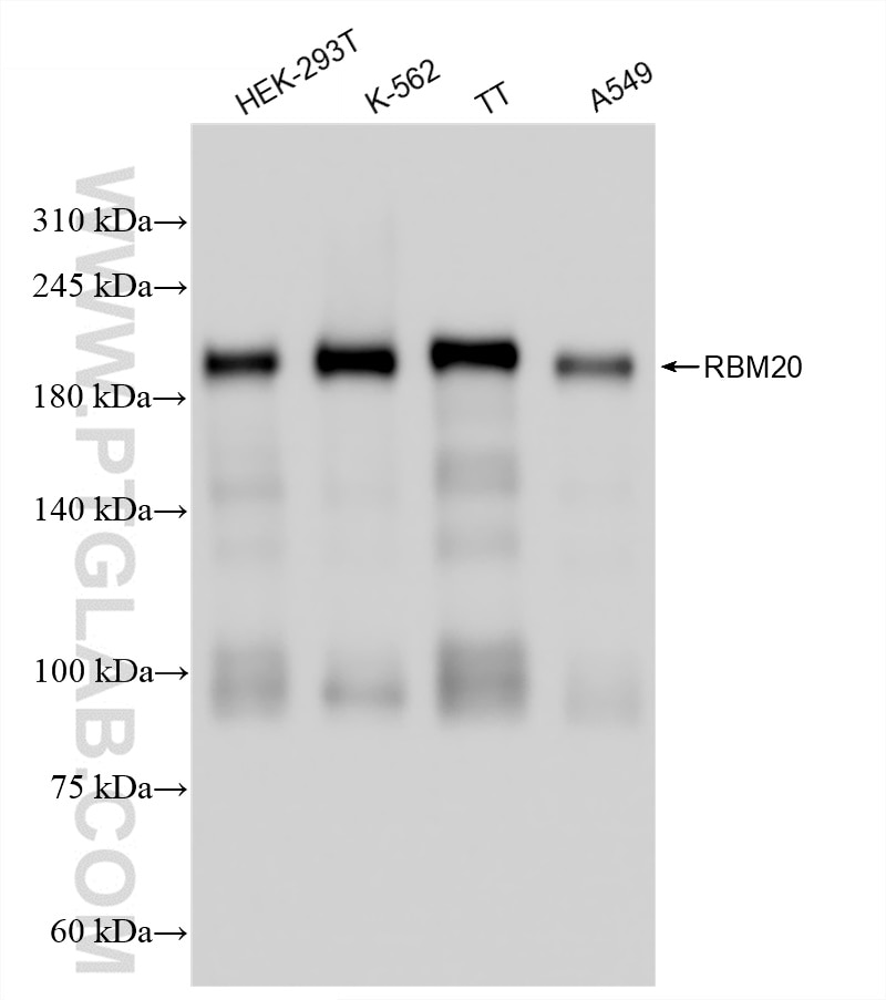 Western Blot (WB) analysis of various lysates using RBM20 Recombinant antibody (83363-1-RR)