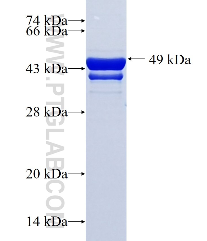 RBM20 fusion protein Ag34322 SDS-PAGE
