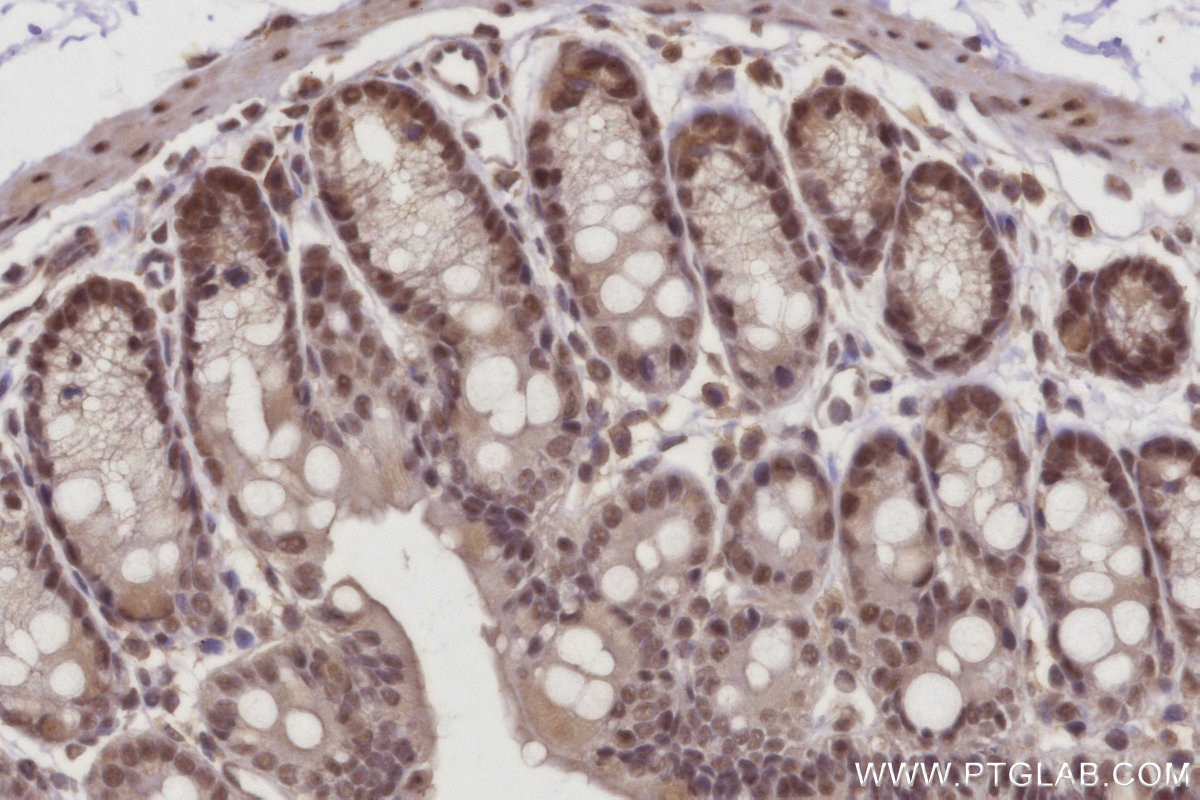 Immunohistochemistry (IHC) staining of mouse colon tissue using RBM22 Polyclonal antibody (22103-1-AP)