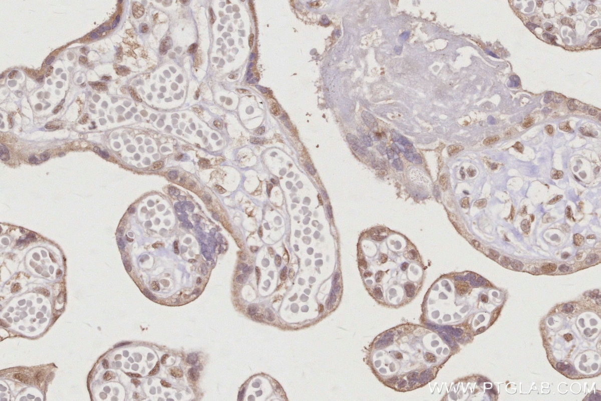 Immunohistochemistry (IHC) staining of human placenta tissue using RBM22 Polyclonal antibody (22103-1-AP)