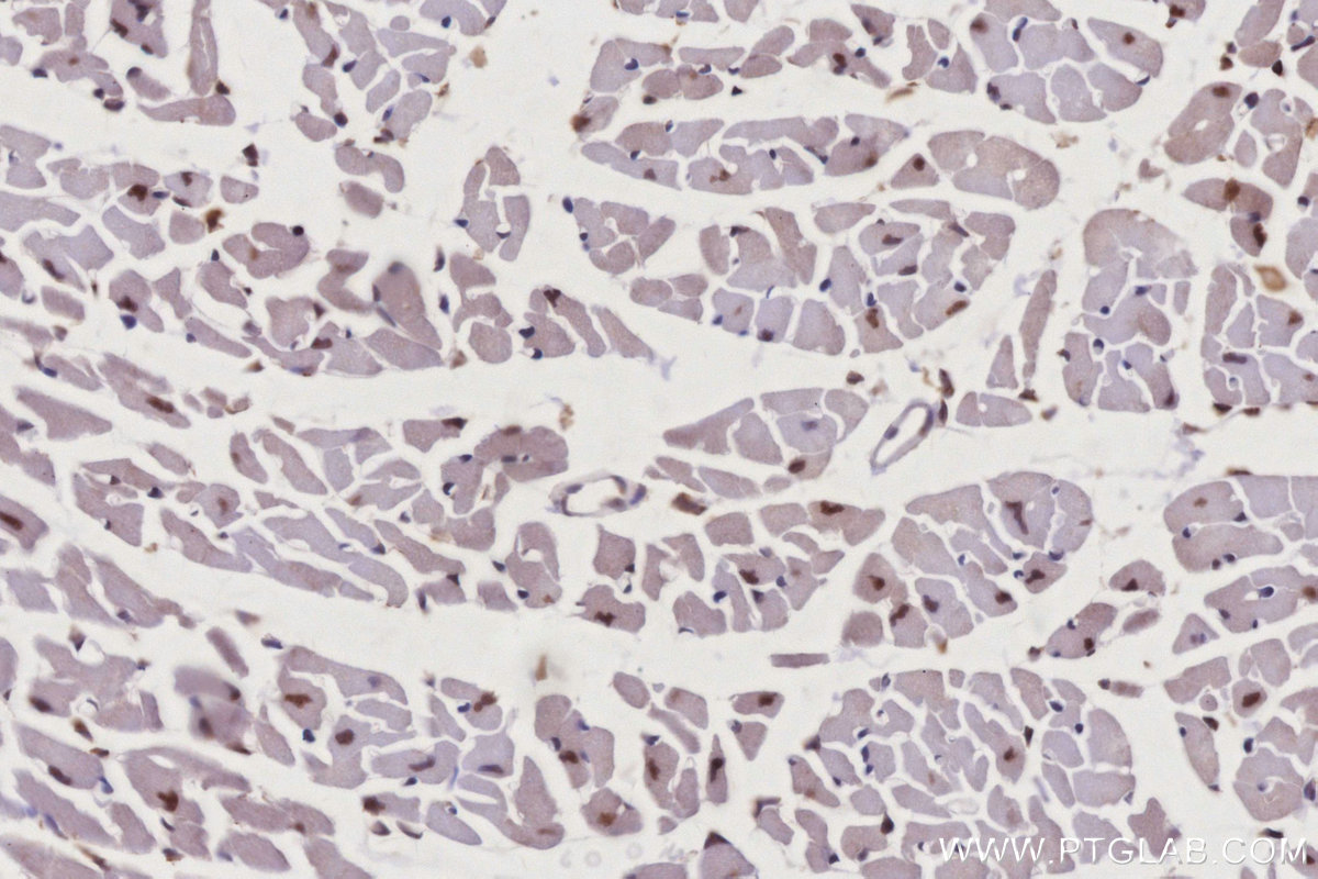 Immunohistochemistry (IHC) staining of mouse heart tissue using RBM22 Polyclonal antibody (22103-1-AP)