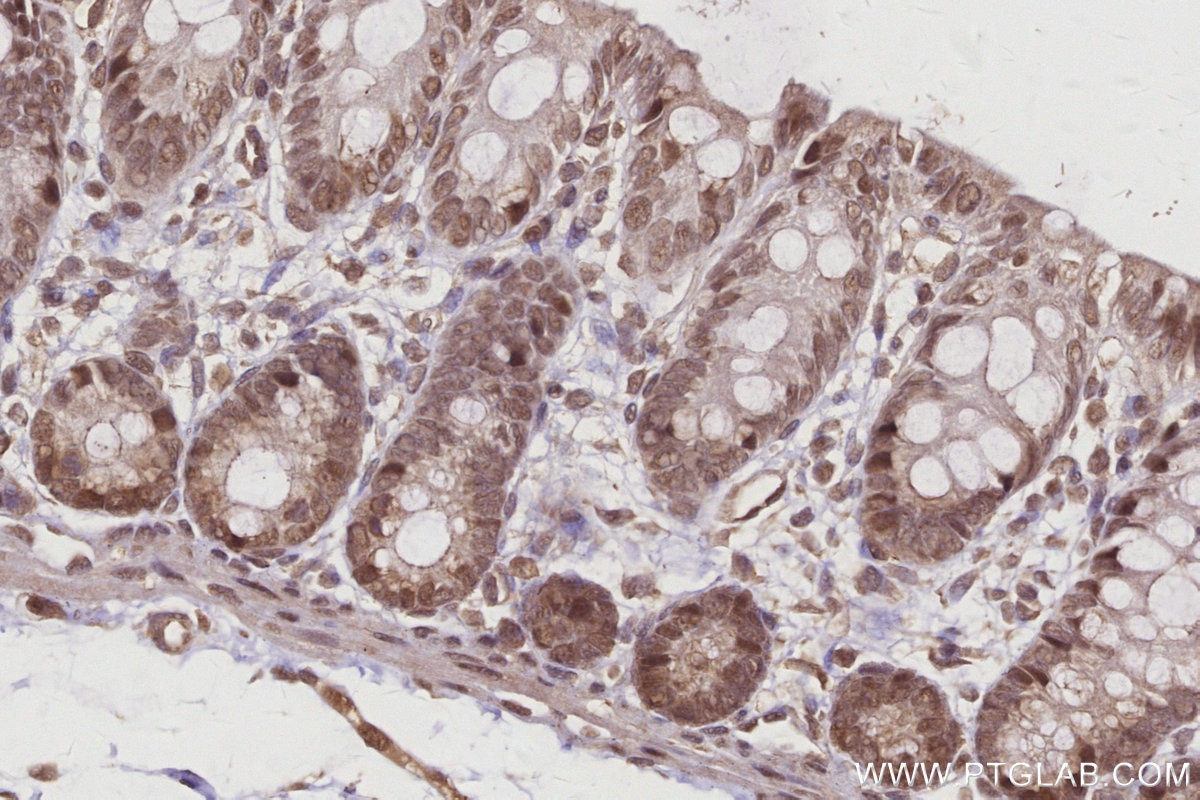 Immunohistochemistry (IHC) staining of rat colon tissue using RBM22 Polyclonal antibody (22103-1-AP)
