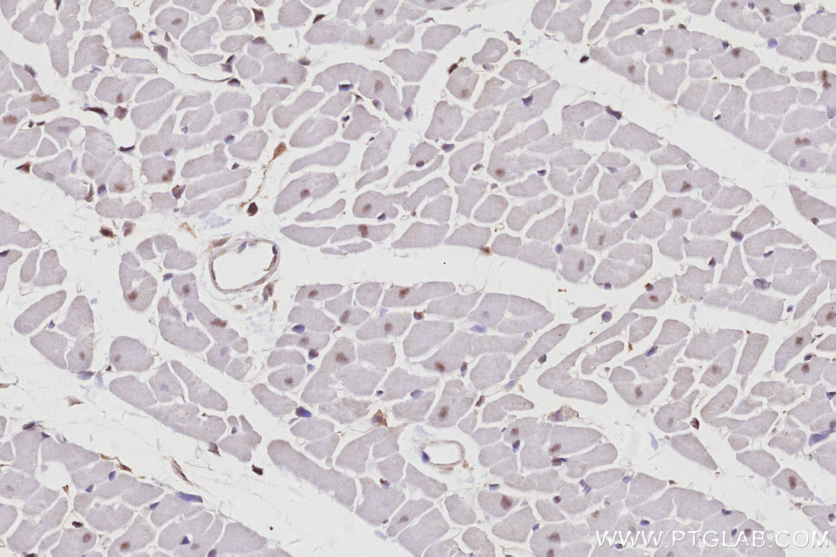 Immunohistochemistry (IHC) staining of rat heart tissue using RBM22 Polyclonal antibody (22103-1-AP)