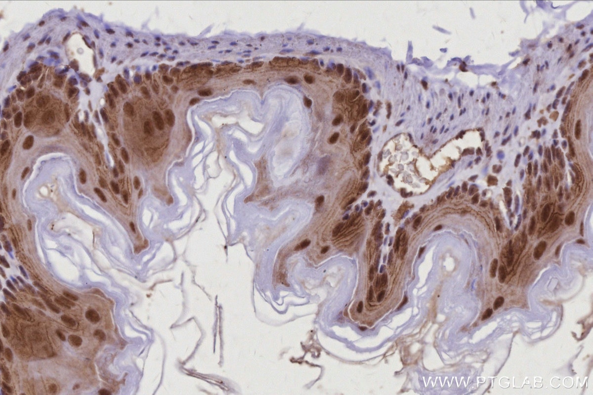 Immunohistochemistry (IHC) staining of mouse stomach tissue using RBM22 Polyclonal antibody (22103-1-AP)