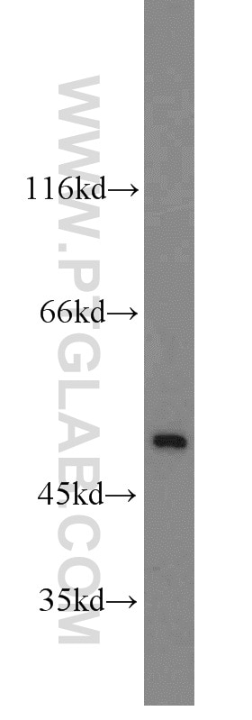 Western Blot (WB) analysis of NIH/3T3 cells using RBM22 Polyclonal antibody (22103-1-AP)